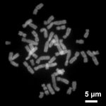 Cromosomas Humanos durante Metafase. Imagen: Steffen Dietzel. CC BY-SA